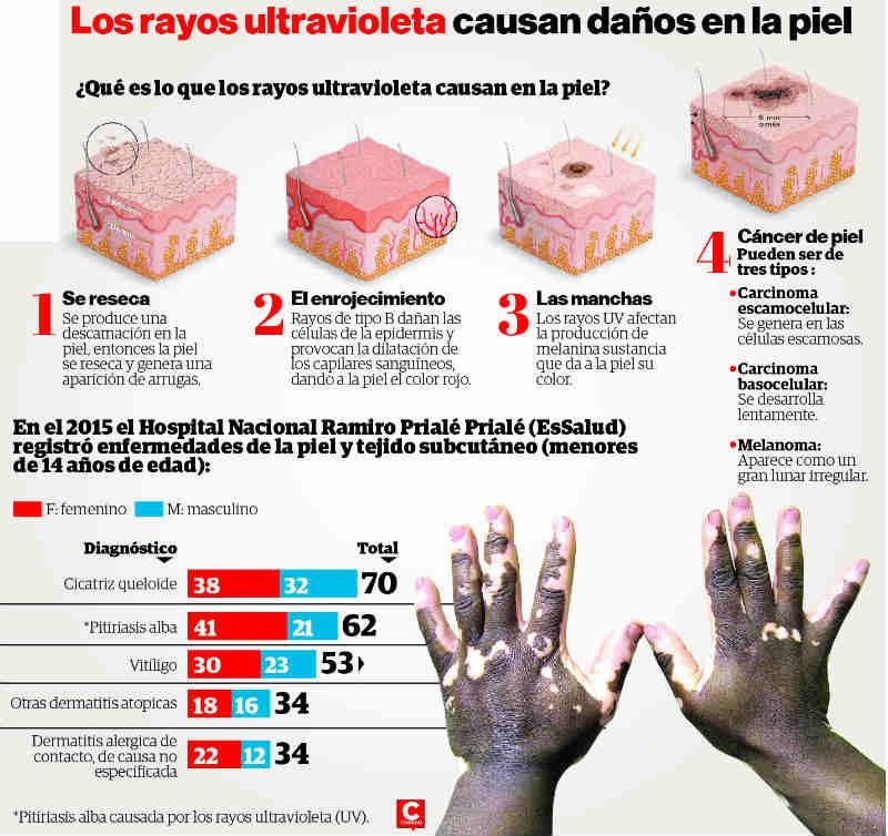 Menores en riesgo por enfermedades a la piel 