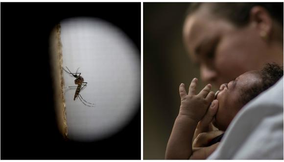 OMS: aumentan evidencias que apunta a vínculo del zika con la microcefalia
