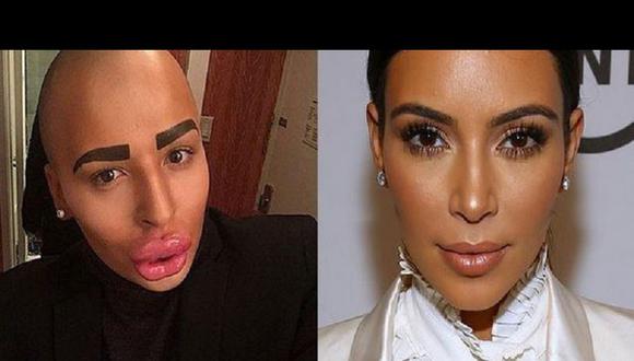Hombre gastó más de 150 mil dólares para parecerse a Kim Kardashian