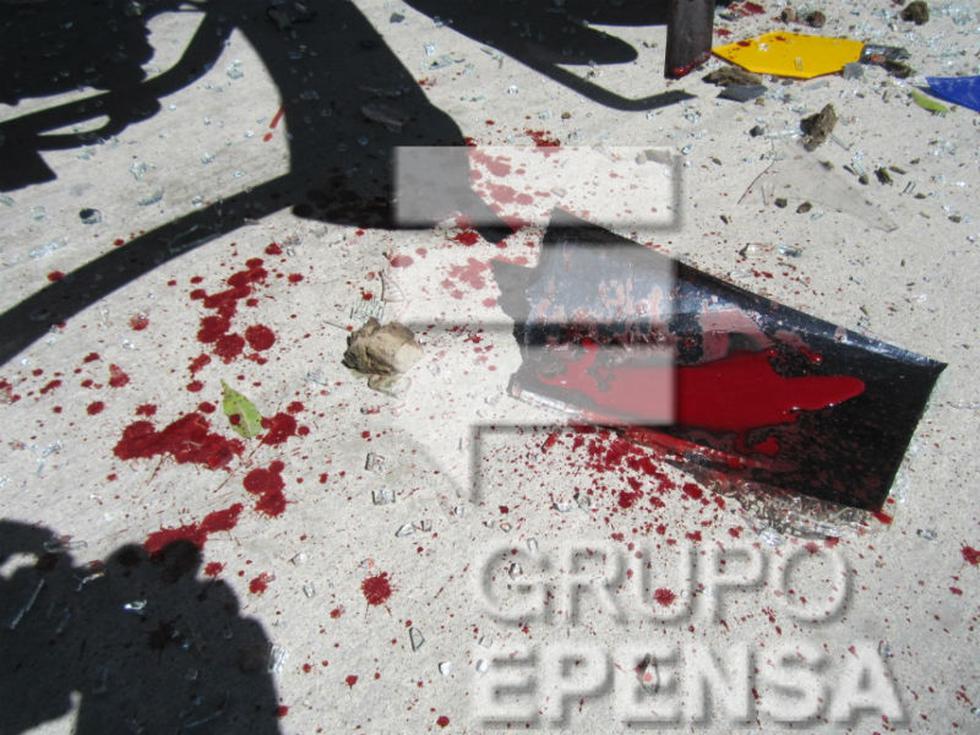 Chofer de motocar se desfigura al impactar unidad con carro lechero (FOTOS)