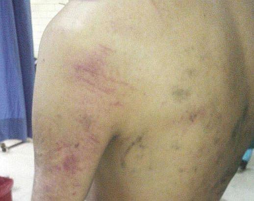 Juliaca: golpean y bañan con agua hervida a sospechoso de ladrón 