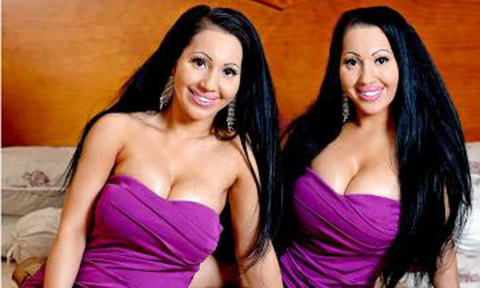 Gemelas se operan para ser idénticas y compartir novio