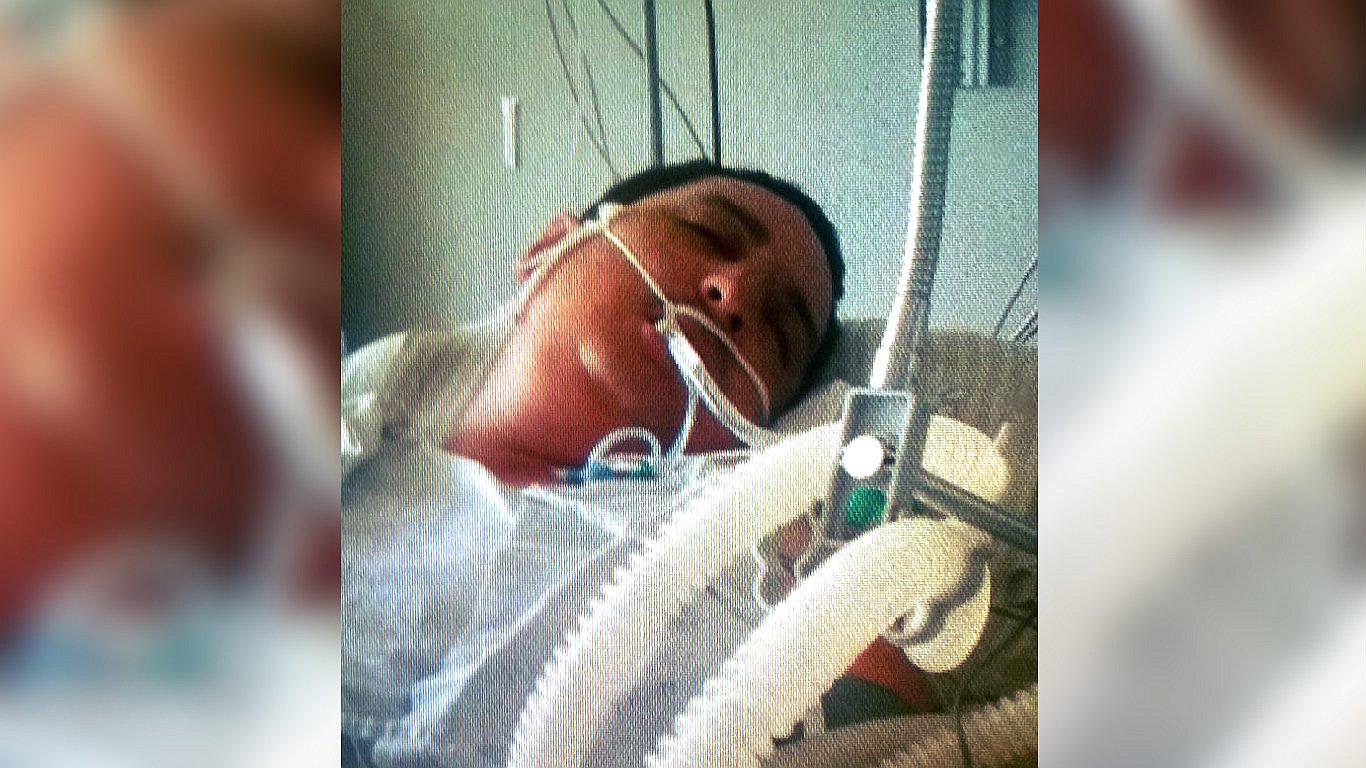 Tacna: chileno grave tras practicarse una rinoplastía en una clínica privada