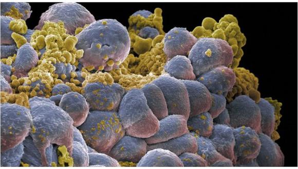 EE.UU.: Científicos consiguen que las células cancerígenas se autodestruyan