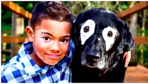 Niño recupera su confianza al conocer a perro con su misma enfermedad (VIDEO)