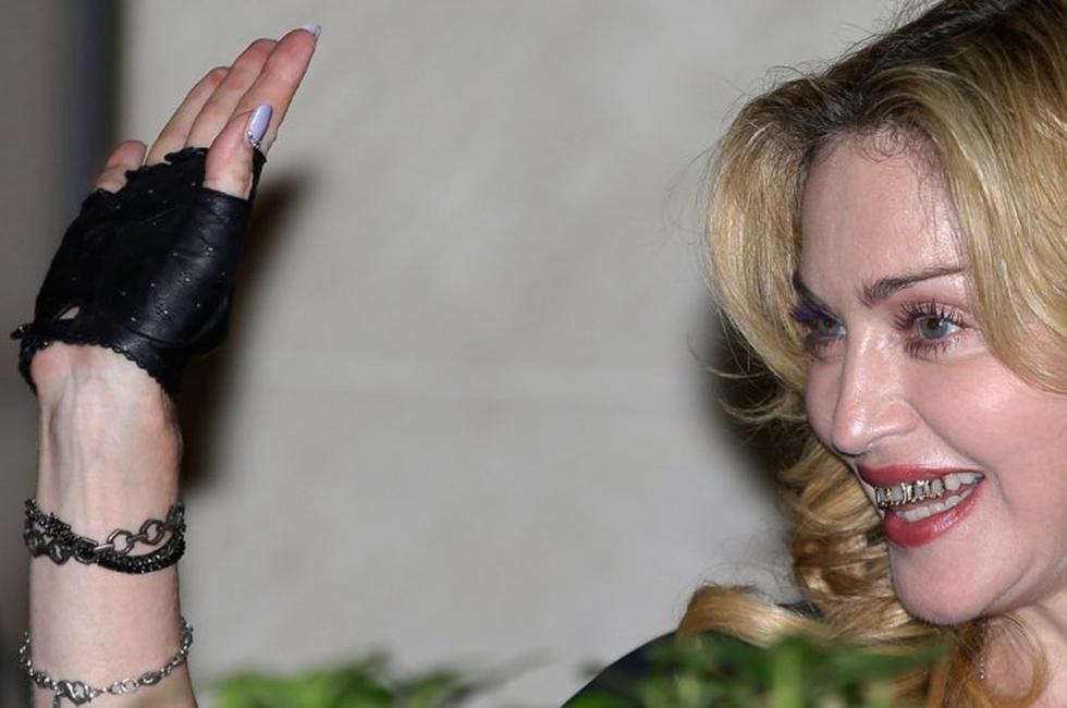 Madonna y sus dientes de oro y brillantes 