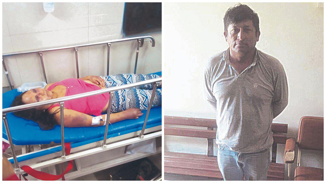 Mujer queda grave al ser masacrada por su esposo en JLO