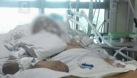 Joven peruano sale de coma tras ser atacado en Arica