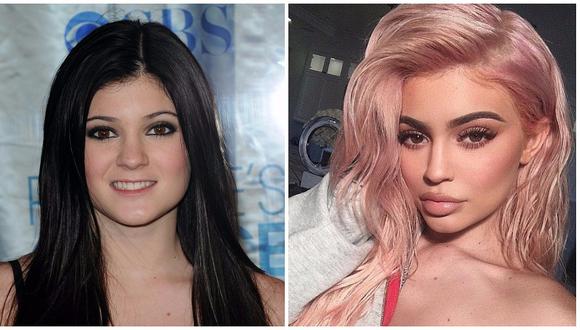 Kylie Jenner confiesa el traumático motivo por el que aumentó el tamaño de sus labios