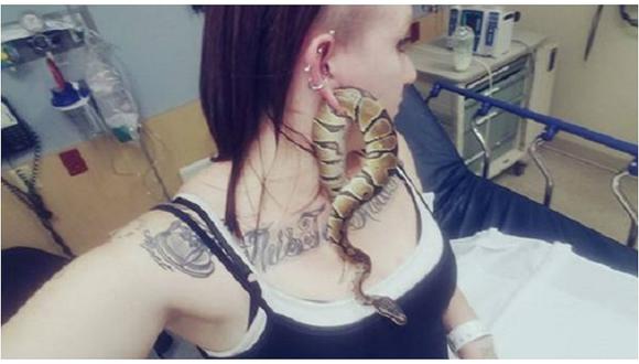 ​Facebook: ¡Insólito! Mujer se presenta en hospital con serpiente incrustada en la oreja