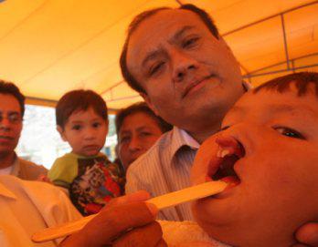 Operan a 30 niños con labio leporino