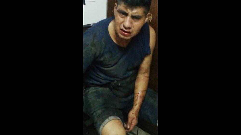 Ate: Policía es detenido tras atacar a transeúnte en aparente estado de ebriedad