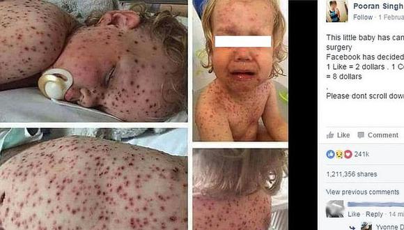 Facebook: Expertos explican el motivo de pedir "Compartir" en fotos de niños enfermos 