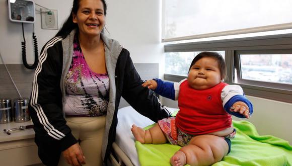 Preocupación por bebé colombiano que pesa 20 kilos y no puede ni gatear