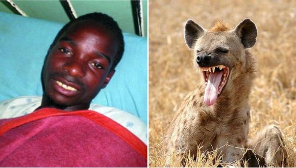 Dejó que una hiena se comiera parte de su cuerpo para ser rico
