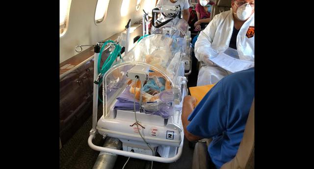 Amazonas. Las gemelas nacieron con los órganos expuestos y requieren una operación compleja. (SAMU)