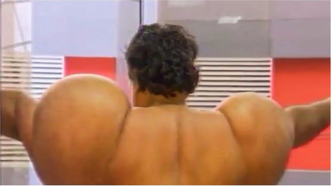 ​Buzo peruano con el cuerpo deformado por bolsas de nitrógeno pide ayuda (VIDEO)