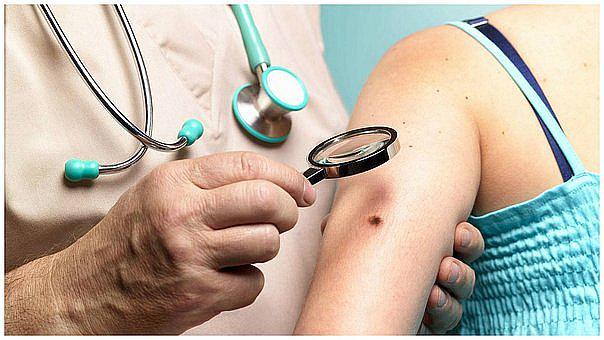 Cáncer: Heridas que no cicatrizan rápido son signo de preocupación (VIDEO)