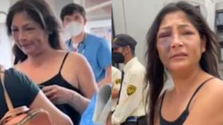 Magaly Solier se negó a recibir atención médica en hospital pese a tener el rostro desfigurado: “No me voy a operar” 