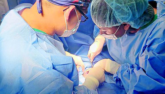 Huancayo: Operan con éxito a un neonato con malrotación intestinal en hospital
