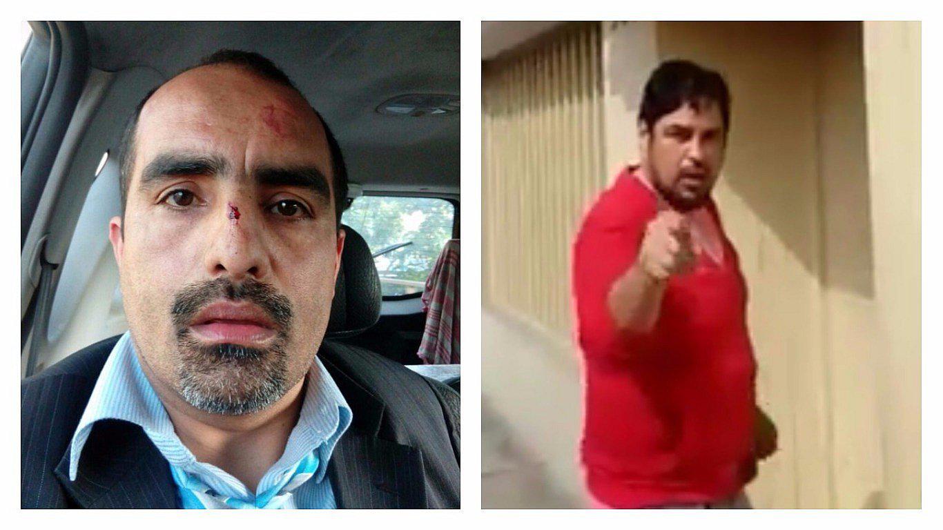 Periodista Fernando Llanos fue golpeado por sujetos que realizaban obra informal en Surquillo (VIDEO)