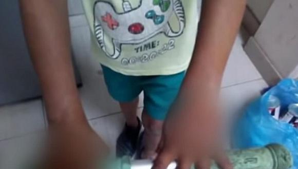 Sujeto quema las manos de su hijastro de 7 años por coger dos soles en VES