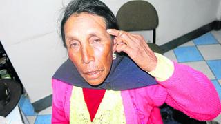 Anciana de Laimina teme por su vida y viaja a Huancavelica en busca de ayuda