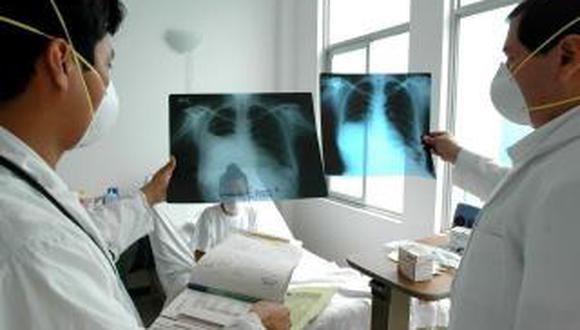 Aumentan los casos de tuberculosis en la región de Tumbes
