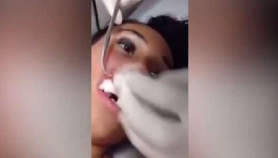 Extraen gusano del labio hinchado de una joven (VIDEO)
