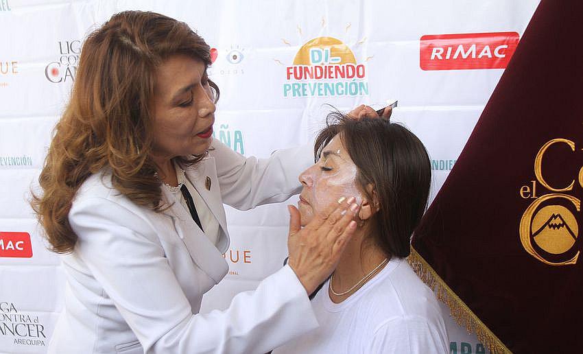 Detectan 33 casos de cáncer de piel en Arequipa
