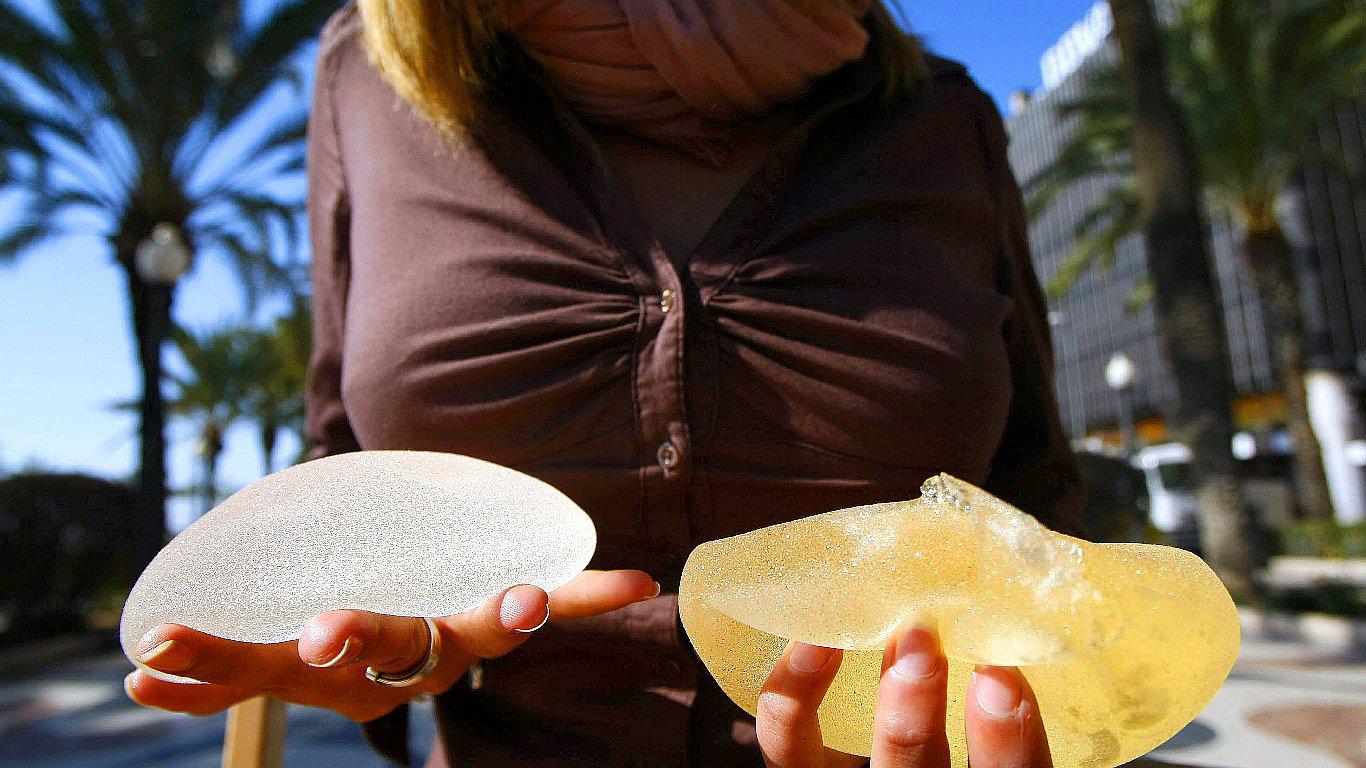 Francia prohíbe varios implantes mamarios por su potencial cancerígeno