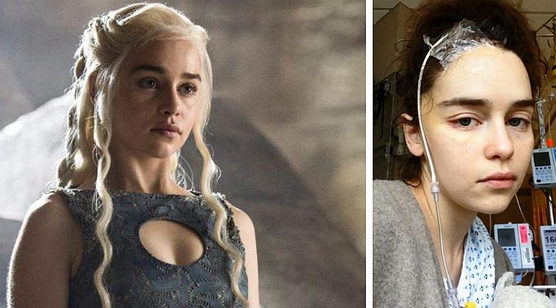 Emilia Clarke revela las intervenciones quirúrgicas a la que fue sometida por su aneurisma (FOTOS)