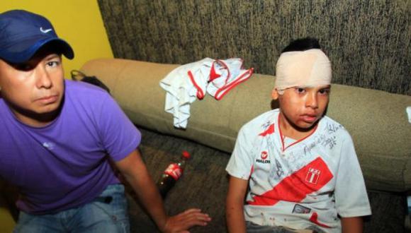 Chilenos atacan a hinchas peruanos y dejan niños heridos