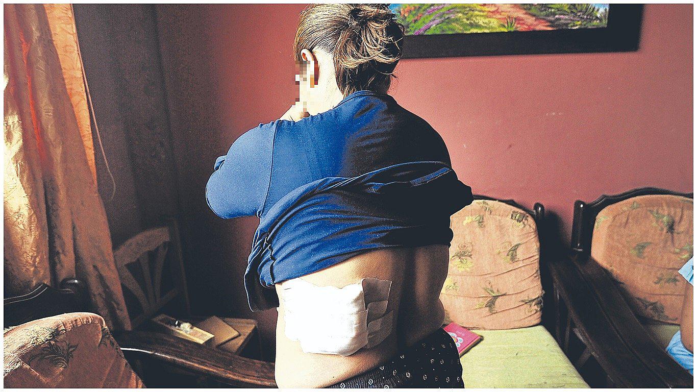 Denuncias por violencia contra la mujer ya superan las 5 mil en la región Áncash  