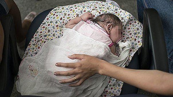 ​Zika en EE.UU: Confirman muerte de bebé con microcefalia asociada al virus