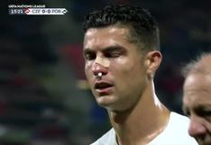 Portugal vs. República Checa: Cristiano Ronaldo terminó sangrando en la UEFA Nations League (VIDEO)