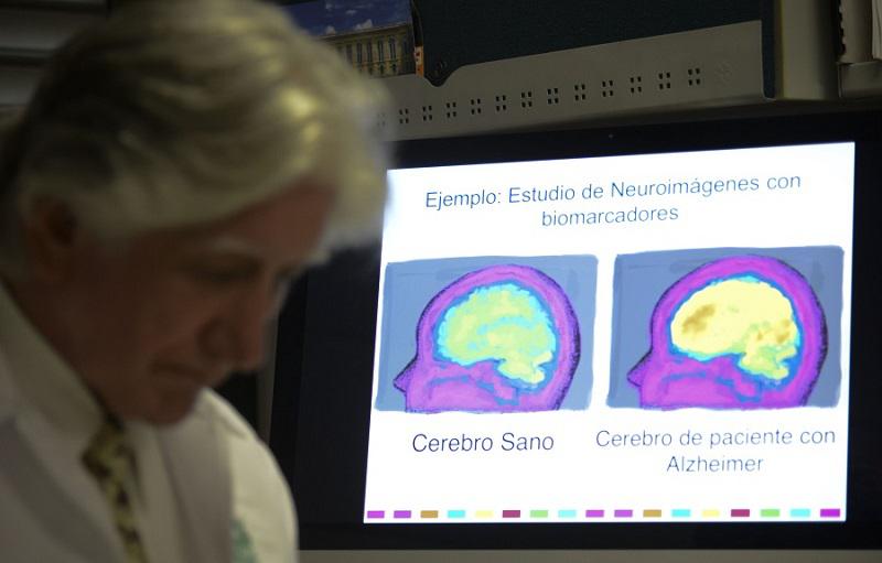 ¿Qué relación tiene la clase de agua que consume con el alzheimer?