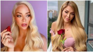 Sheyla Rojas se somete a nuevo retoque estético en los labios y lo muestran en redes sociales (VIDEO)