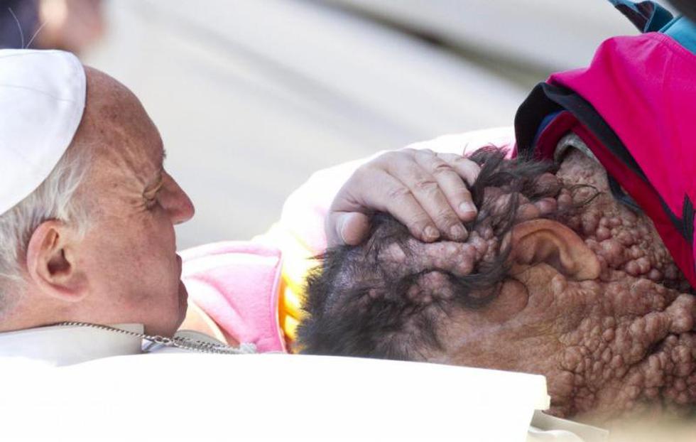 Papa Francisco abrazó y consoló a enfermo en el Vaticano (FOTOS)