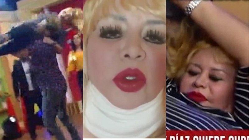 Susy Díaz muestra sus ‘lesiones’ que sufrió cuando realizó el ‘baile del helicóptero’ 