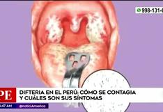 Difteria en Perú: conoce todo sobre la enfermedad y quiénes están expuestos