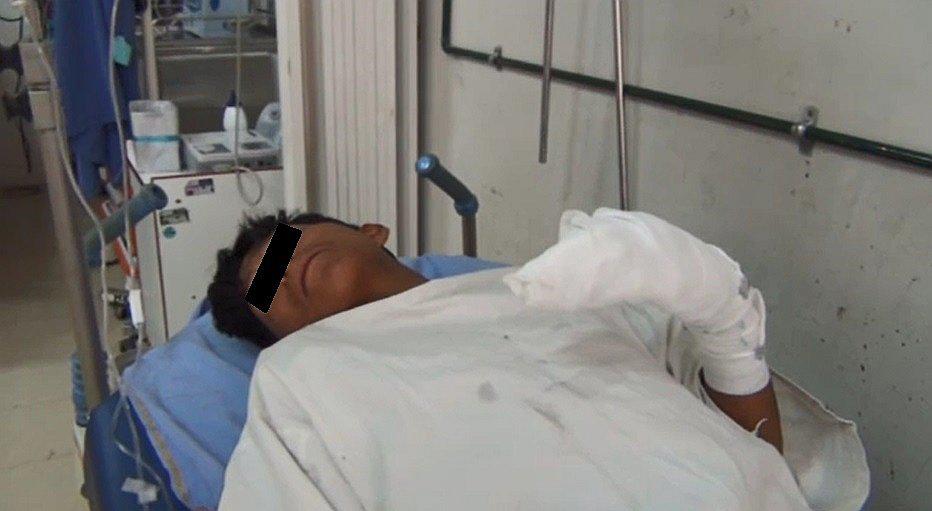 Dos personas se vuelan los dedos de la mano con una 'mama rata'