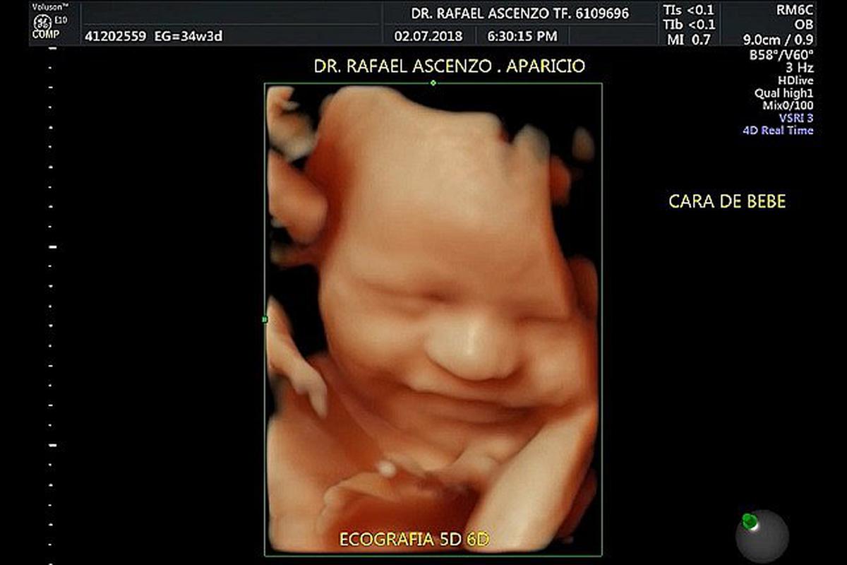 Ecografia 6d Asi Sonrie Un Bebe Dentro Del Vientre Materno Miscelanea Correo