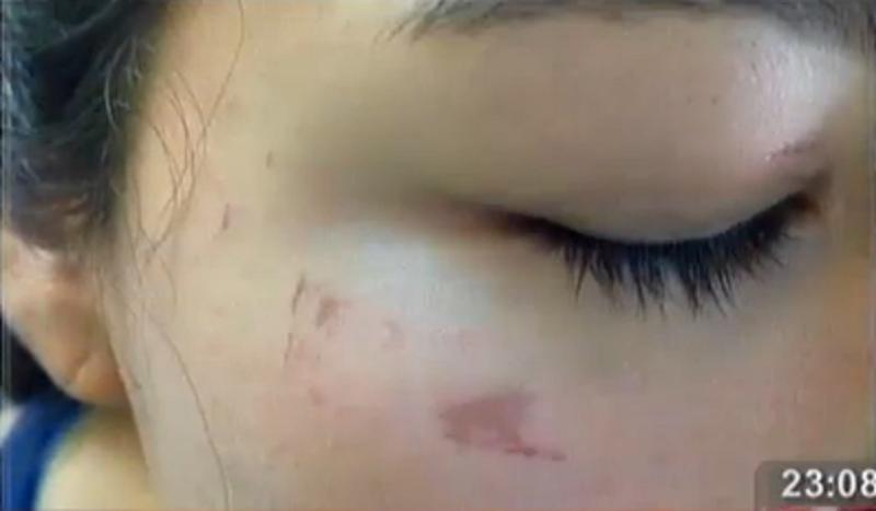 ​Tula Rodríguez: Joven sufre quemadura de rostro en spa (VIDEO)