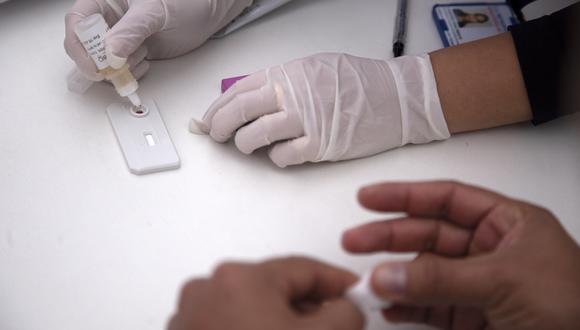 Un hombre se realiza una prueba rápida de VIH en Santiago, Chile. (Foto: CLAUDIO REYES / AFP)