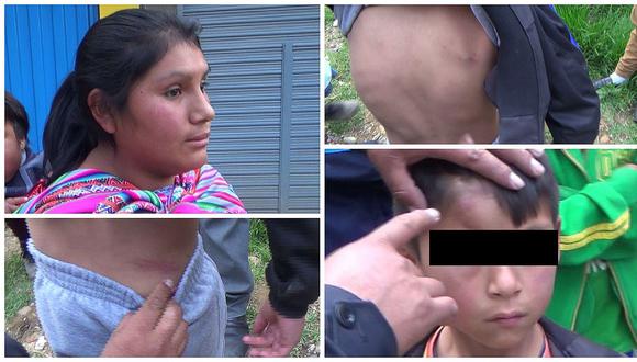 Mujer golpea con manguera a su hijo que momentos antes cayó del segundo piso  (VIDEO)