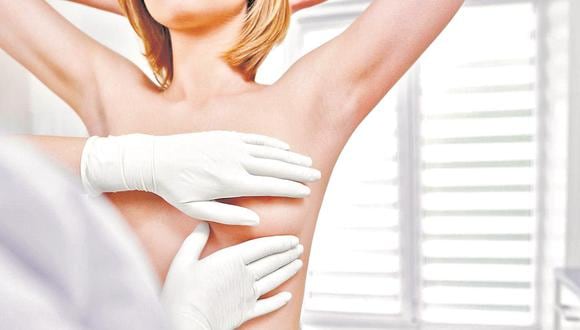 “El cáncer de mama, en un estadio temprano, no tiene como síntoma natural el dolor en el seno”
