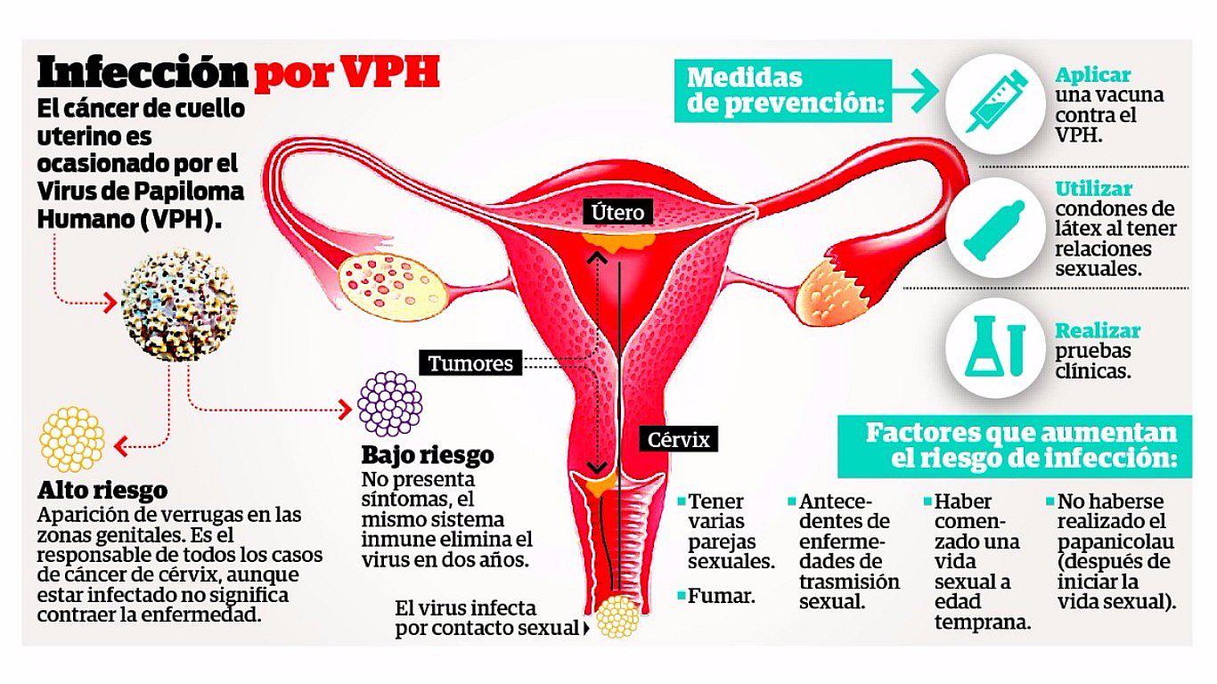 ​121 mujeres con diagnóstico de cáncer de cuello uterino en Junín