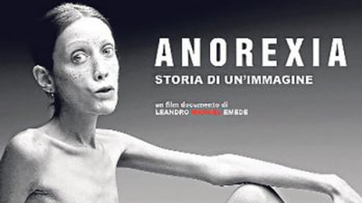 anuncios de anorexia