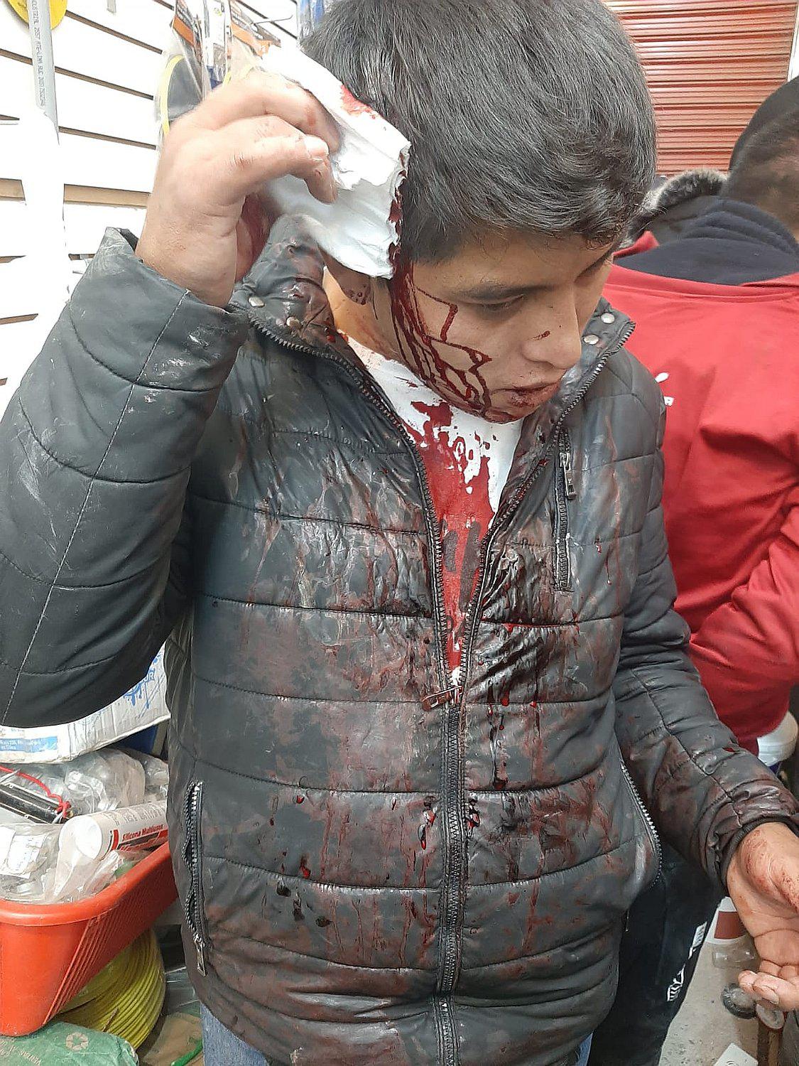 Hieren en la cabeza a PNP en operativo a ferreterías en Juliaca